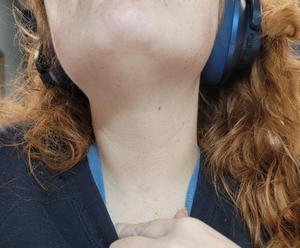 Preview thumbnail for [Misc] what is going on with my neck?