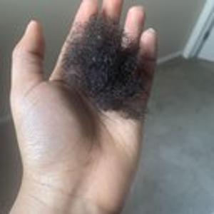 Preview thumbnail for Is it normal to lose this much hair after three weeks of wearing twists?