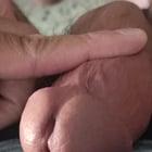 Preview thumbnail for My penis!