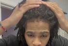 Preview thumbnail for Do I get a line-up before or after retwist? I grew out a hairline n didn’t cut any locs. I combed my baby hairs out